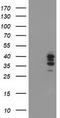 Signal Sequence Receptor Subunit 1 antibody, TA503144, Origene, Western Blot image 