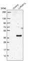 Leucine Rich Adaptor Protein 1 Like antibody, NBP1-90796, Novus Biologicals, Western Blot image 