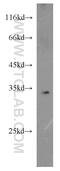 60S ribosomal protein L8 antibody, 16981-1-AP, Proteintech Group, Western Blot image 