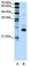 Recoverin antibody, TA335802, Origene, Western Blot image 
