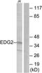 Lysophosphatidic Acid Receptor 1 antibody, TA311880, Origene, Western Blot image 