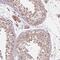 RNA Polymerase III Subunit F antibody, HPA050173, Atlas Antibodies, Immunohistochemistry paraffin image 