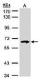 Glucosylceramidase Beta antibody, LS-C185394, Lifespan Biosciences, Western Blot image 