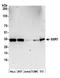Signal Sequence Receptor Subunit 1 antibody, A304-978A, Bethyl Labs, Western Blot image 