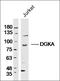 Diacylglycerol Kinase Alpha antibody, orb183080, Biorbyt, Western Blot image 
