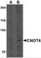 CCR4-NOT Transcription Complex Subunit 4 antibody, 4813, ProSci Inc, Western Blot image 