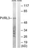 Nectin Cell Adhesion Molecule 3 antibody, LS-C120224, Lifespan Biosciences, Western Blot image 