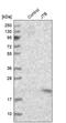 Jumping Translocation Breakpoint antibody, PA5-52307, Invitrogen Antibodies, Western Blot image 