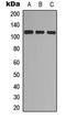 EPH Receptor A7 antibody, LS-C356017, Lifespan Biosciences, Western Blot image 