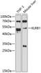 Killer Cell Lectin Like Receptor B1 antibody, 14-141, ProSci, Western Blot image 