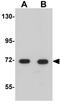 Cell division cycle protein 16 homolog antibody, GTX17065, GeneTex, Western Blot image 