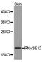 Ribonuclease A Family Member 12 (Inactive) antibody, PA5-37411, Invitrogen Antibodies, Western Blot image 