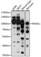 RAS Protein Activator Like 1 antibody, 15-884, ProSci, Western Blot image 