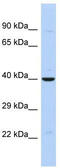 Zinc Finger Protein 551 antibody, TA345577, Origene, Western Blot image 