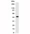 Keratin 17 antibody, 34-145, ProSci, Western Blot image 