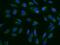 Polyribonucleotide Nucleotidyltransferase 1 antibody, 202989-T02, Sino Biological, Immunohistochemistry paraffin image 