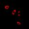 CALCOCO2 antibody, orb341283, Biorbyt, Immunofluorescence image 