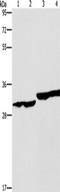 2,4-Dienoyl-CoA Reductase 1 antibody, TA351129, Origene, Western Blot image 