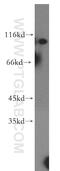 Rab GTPase-activating protein 1-like antibody, 13894-1-AP, Proteintech Group, Western Blot image 