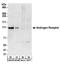 Androgen Receptor antibody, A303-965A, Bethyl Labs, Western Blot image 