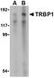 TAR (HIV-1) RNA Binding Protein 1 antibody, NBP1-76400, Novus Biologicals, Western Blot image 