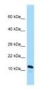 ADP Ribosylation Factor Like GTPase 2 Binding Protein antibody, NBP1-98397, Novus Biologicals, Western Blot image 