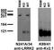 Leucine Rich Repeat Kinase 2 antibody, 75-253, Antibodies Incorporated, Western Blot image 