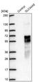 Solute Carrier Family 44 Member 5 antibody, NBP2-30869, Novus Biologicals, Western Blot image 