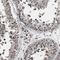 Round Spermatid Basic Protein 1 Like antibody, NBP1-81902, Novus Biologicals, Immunohistochemistry frozen image 