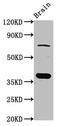 Secretory carrier-associated membrane protein 1 antibody, CSB-PA020750LA01HU, Cusabio, Western Blot image 