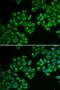 3-Hydroxy-3-Methylglutaryl-CoA Reductase antibody, LS-C331599, Lifespan Biosciences, Immunofluorescence image 