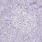 Cytochrome P450 Family 17 Subfamily A Member 1 antibody, HPA048533, Atlas Antibodies, Immunohistochemistry frozen image 