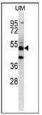 Pancreatic Lipase Related Protein 3 antibody, AP53367PU-N, Origene, Western Blot image 