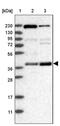 S100P Binding Protein antibody, PA5-55555, Invitrogen Antibodies, Western Blot image 