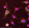 Stearoyl-CoA Desaturase antibody, ab39969, Abcam, Immunocytochemistry image 