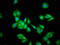 3-Hydroxy-3-Methylglutaryl-CoA Synthase 2 antibody, LS-C670470, Lifespan Biosciences, Immunofluorescence image 