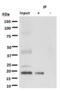 Ras antibody, M00099-1, Boster Biological Technology, Immunoprecipitation image 