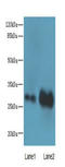 Exosome Component 8 antibody, A66990-100, Epigentek, Western Blot image 
