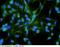 CDH2 antibody, 11039-R020, Sino Biological, Immunohistochemistry paraffin image 