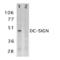 CD209 antigen antibody, AHP627, Bio-Rad (formerly AbD Serotec) , Immunohistochemistry frozen image 