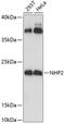 NHP2 Ribonucleoprotein antibody, GTX66475, GeneTex, Western Blot image 
