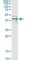 Ring Finger Protein 113B antibody, H00140432-M02, Novus Biologicals, Immunoprecipitation image 
