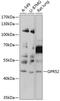G Protein-Coupled Receptor 52 antibody, 14-348, ProSci, Western Blot image 
