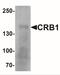 Crumbs homolog 1 antibody, NBP2-41201, Novus Biologicals, Western Blot image 