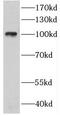 CTAGE Family Member 6 antibody, FNab02045, FineTest, Western Blot image 