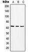 Monocarboxylate transporter 8 antibody, LS-B16464, Lifespan Biosciences, Western Blot image 