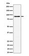 ArfGAP With Coiled-Coil, Ankyrin Repeat And PH Domains 2 antibody, M09294-1, Boster Biological Technology, Western Blot image 