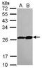 Proteasome Subunit Beta 3 antibody, GTX109566, GeneTex, Western Blot image 
