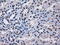 Replication Protein A2 antibody, M02067-1, Boster Biological Technology, Immunohistochemistry paraffin image 