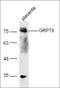 Heat Shock Protein Family A (Hsp70) Member 5 antibody, orb10751, Biorbyt, Western Blot image 
